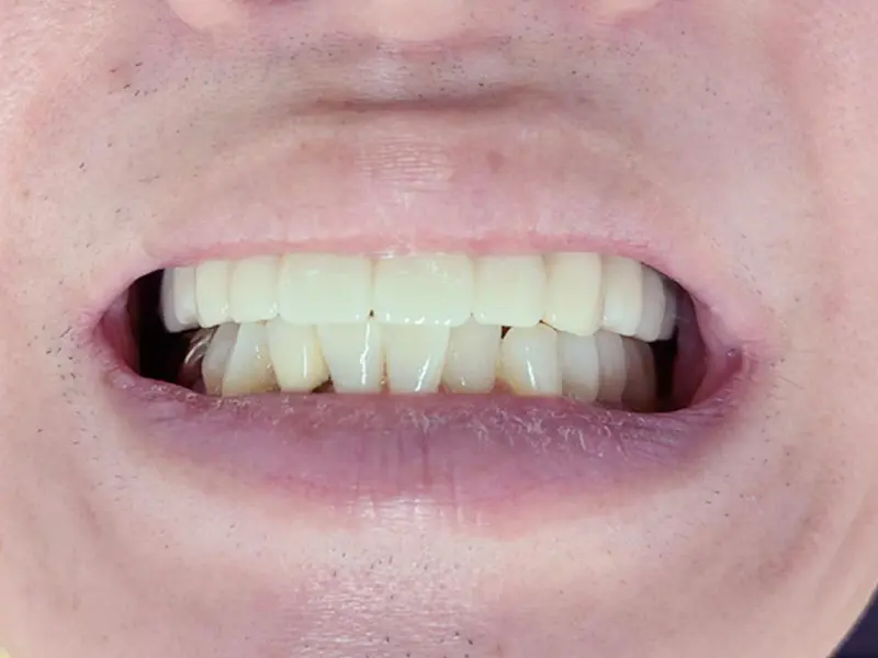 症例その１
